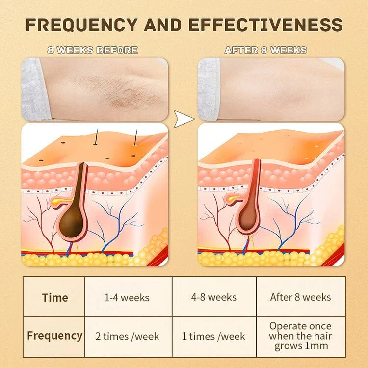 MomDaughts IPL Laser Hair Removal Device